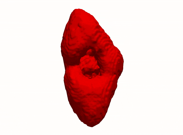 Kidney DIXON nnUNET