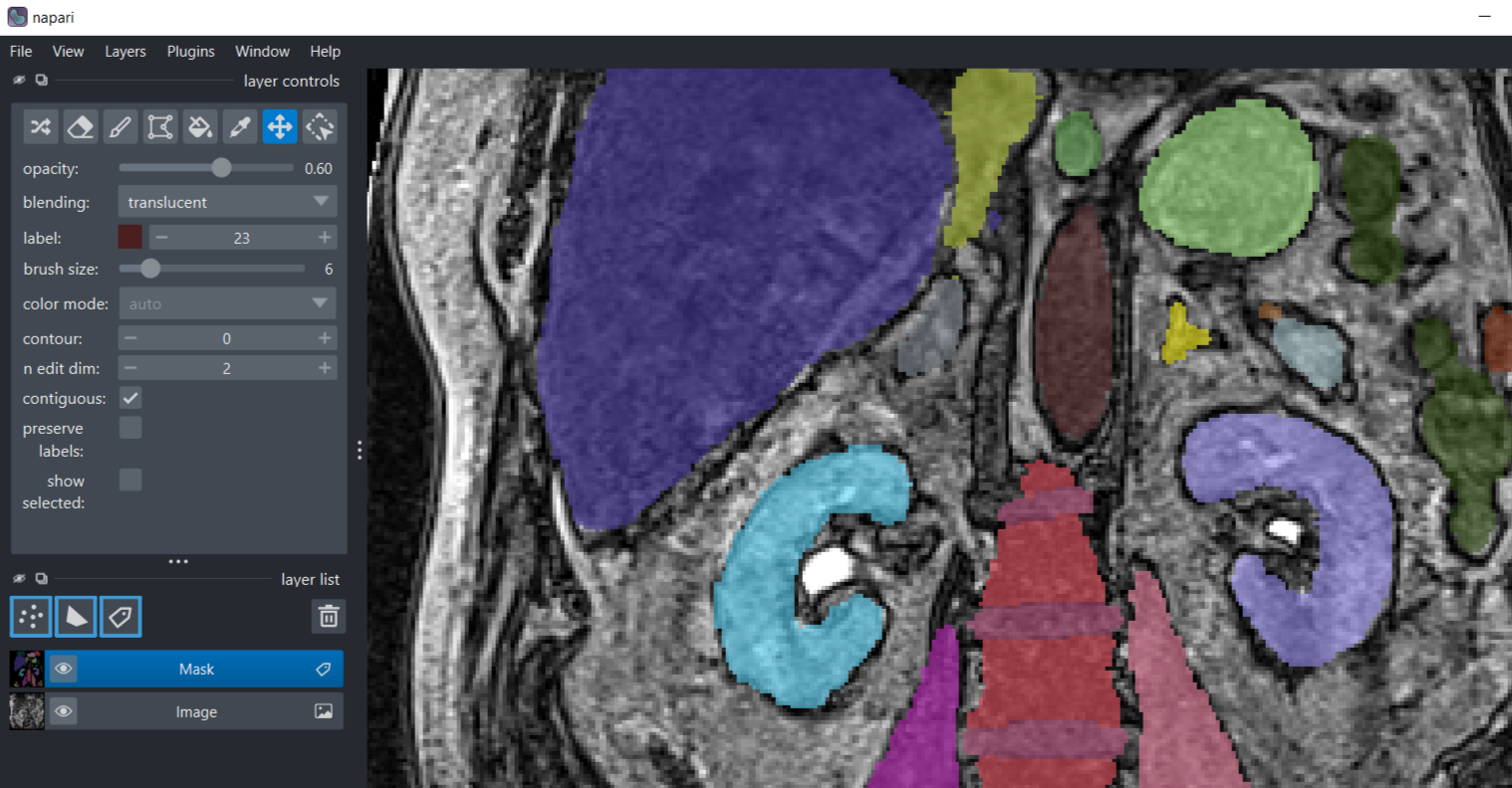 Organ shape features
