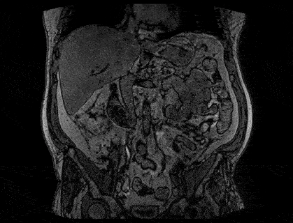 Kidney DIXON UNETR
